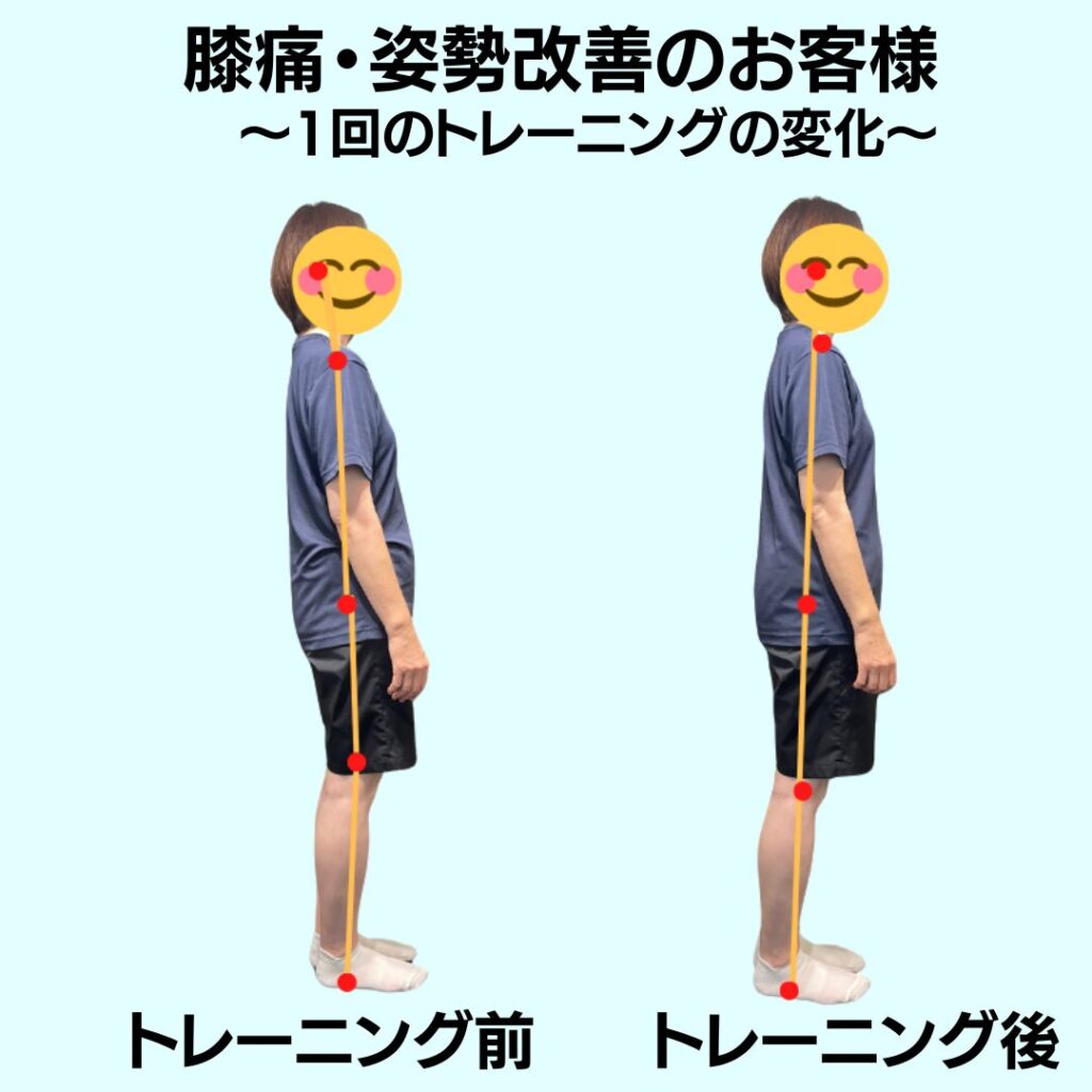 膝痛改善