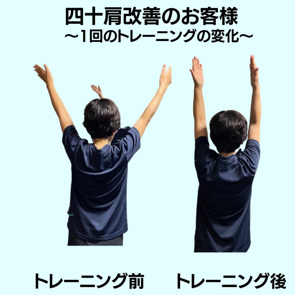 四十肩
